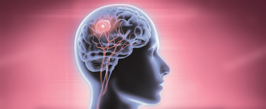 Brain Tumor: Types, Risk Factors, Symptoms, and Treatment