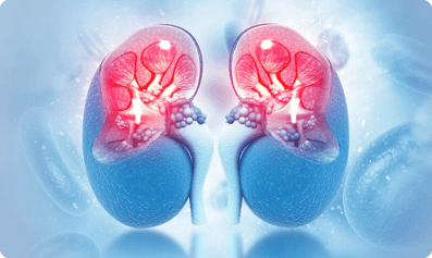 other kidney disease