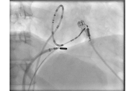 fluoroscopy 1