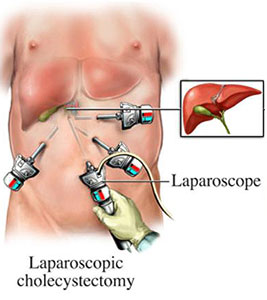 gall bladder