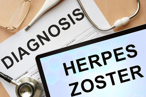 everything you need to know about herpes