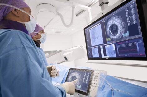 Non-Invasive imaging methods to treat Heart Blockages