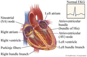 Comprehensive Guide on Heart Palpitations - Insights from Heart Specialists