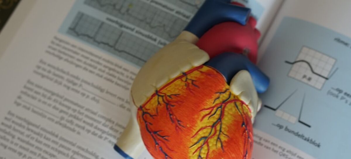 Know About Cardiac Arrhythmia – Irregular Heartbeat