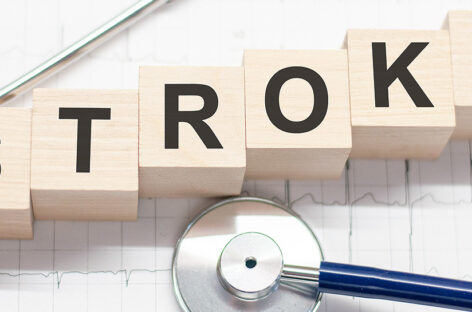 Be ‘FAST’ On Managing Stroke