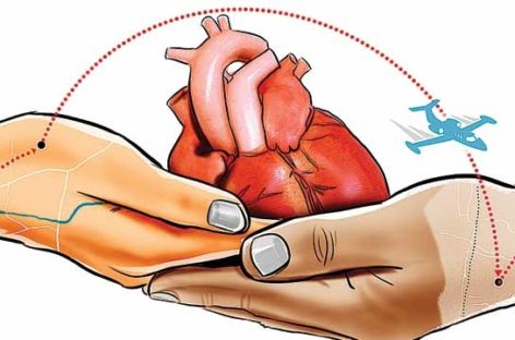 Heart Transplantation: Questions you always wanted to ask