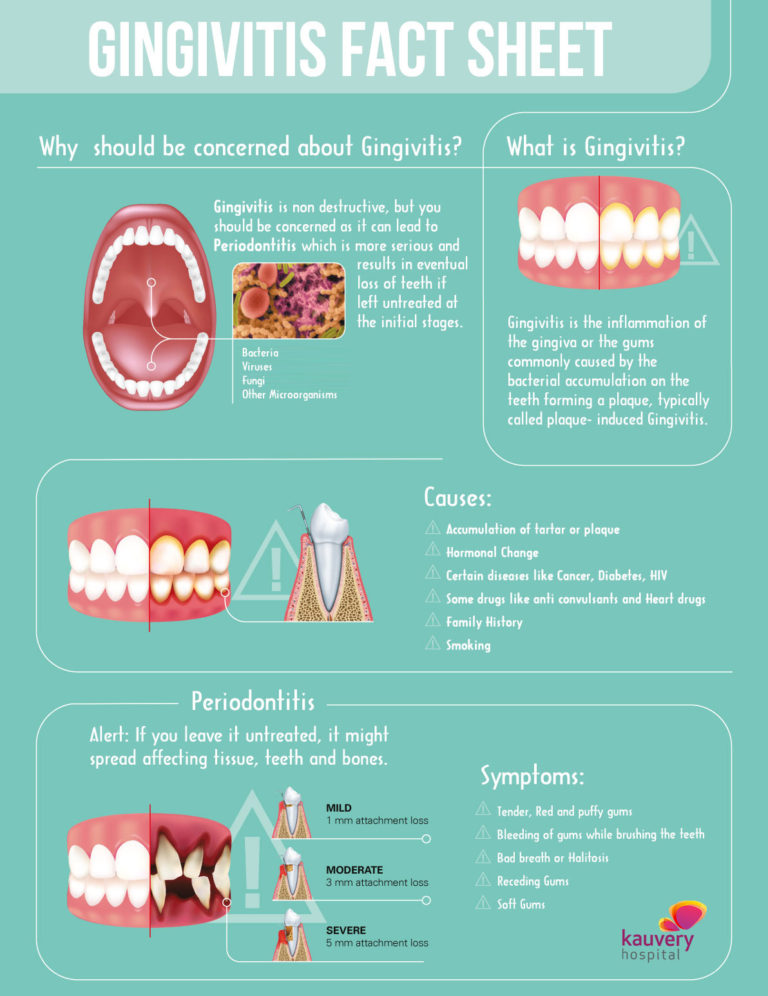 What is Gingivitis? – Infographic | Kauvery Hospital