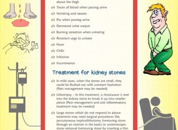 Kidney Stone Causes, Symptoms and Treatments