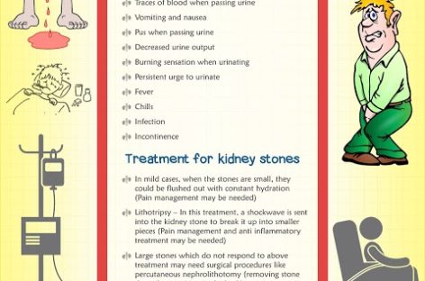 Kidney Stone Causes, Symptoms and Treatments