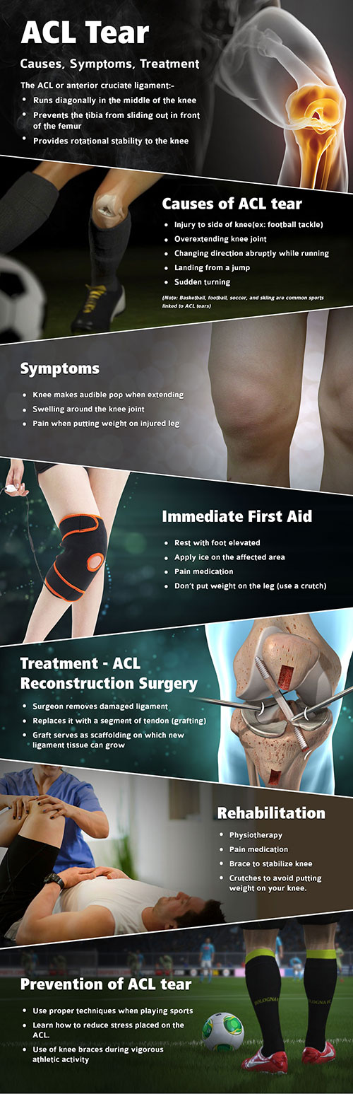 acl pain