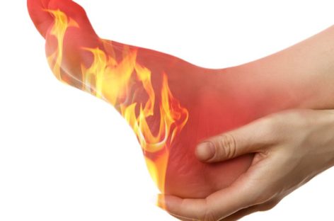 I have a burning sensation on my feet. Why are my feet on fire?