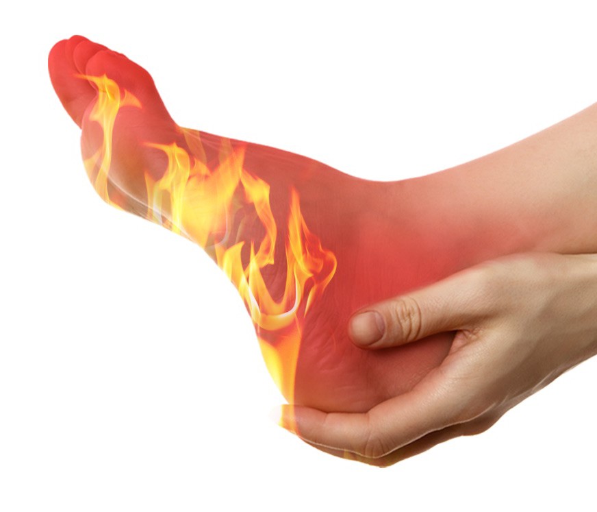 Burning Sensation In Feet Causes Diagnosis And Effective Treatment