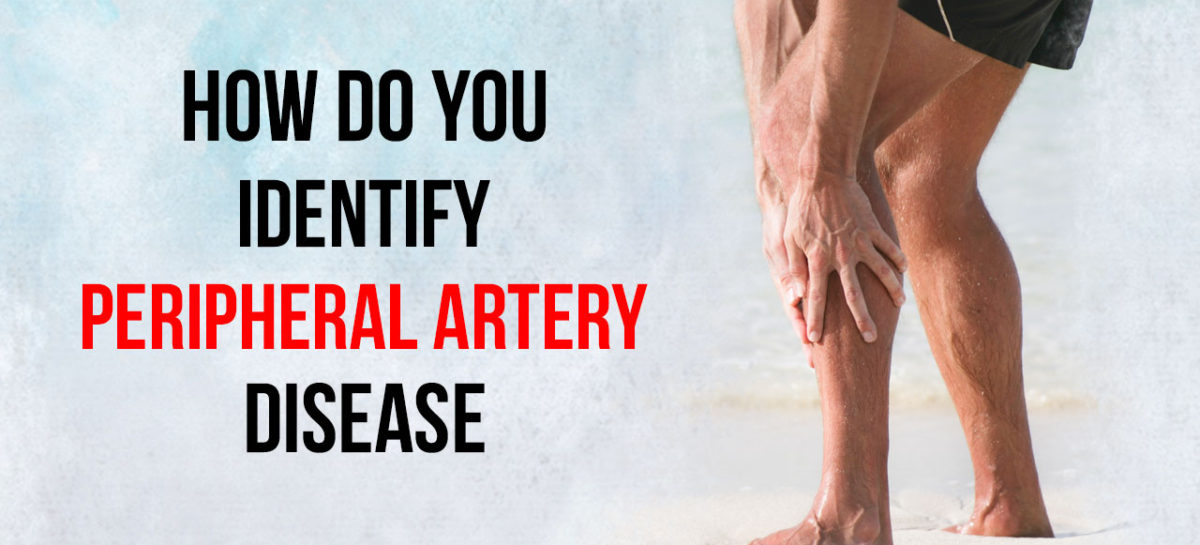 How do you identify Peripheral Artery Disease?