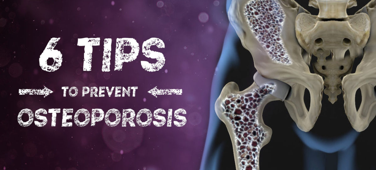 6 Tips to Prevent Osteoporosis