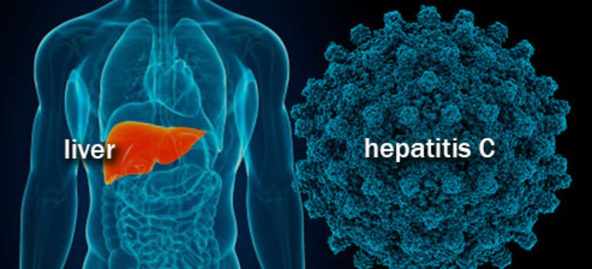 What causes Hepatitis C?
