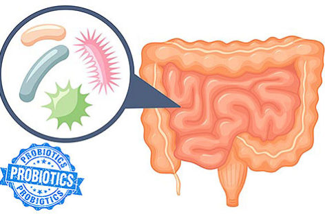 Understanding probiotics and their use