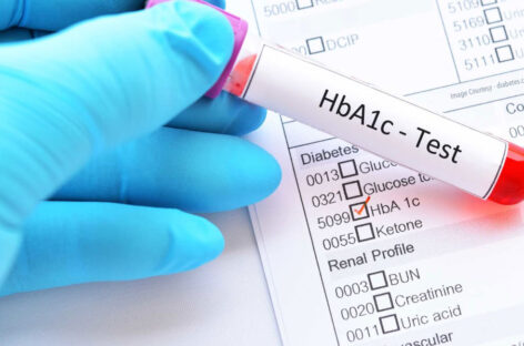 FAQs on HBA1C Test