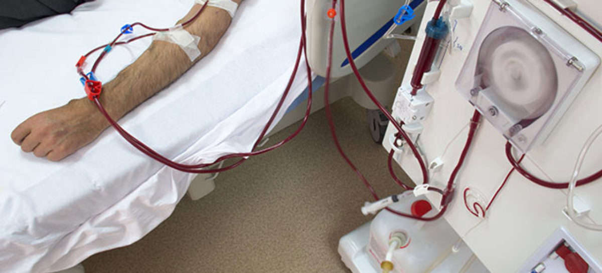what-is-dialysis-difference-between-hemodialysis-peritoneal-dialysis