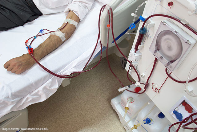 What Is Dialysis Difference Between Hemodialysis Peritoneal Dialysis