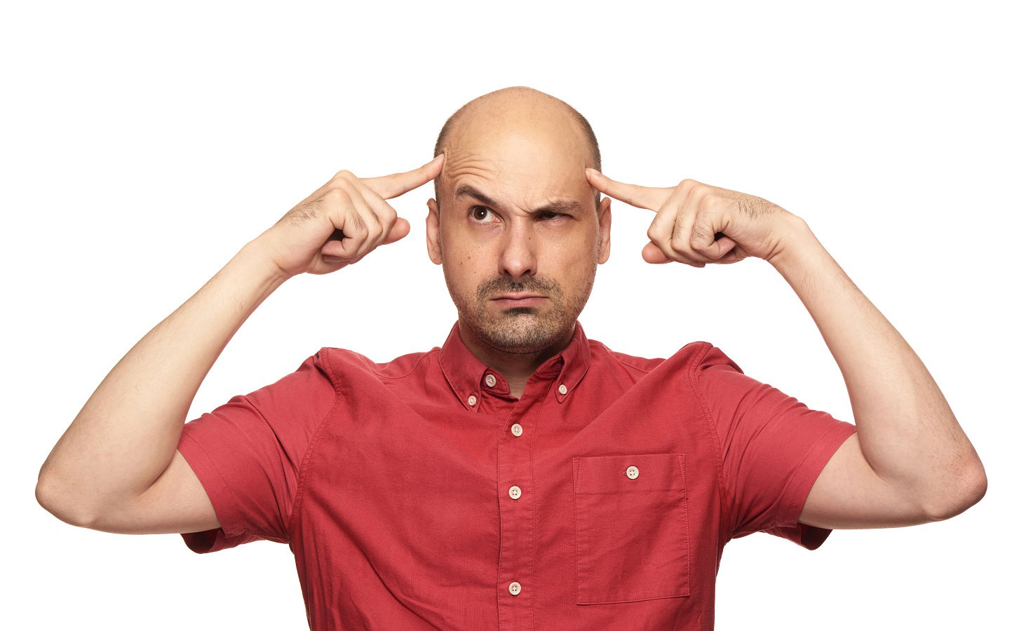 Why do men go bald?