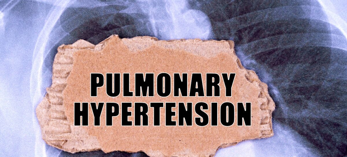 Pulmonary Hypertension – Symptoms and Treatment