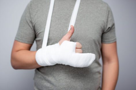 How much time does a broken bone take to heal?