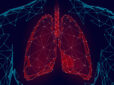 The Procedure of Lung Transplantation