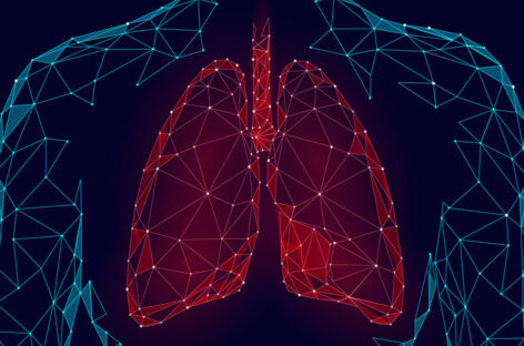 The Procedure of Lung Transplantation