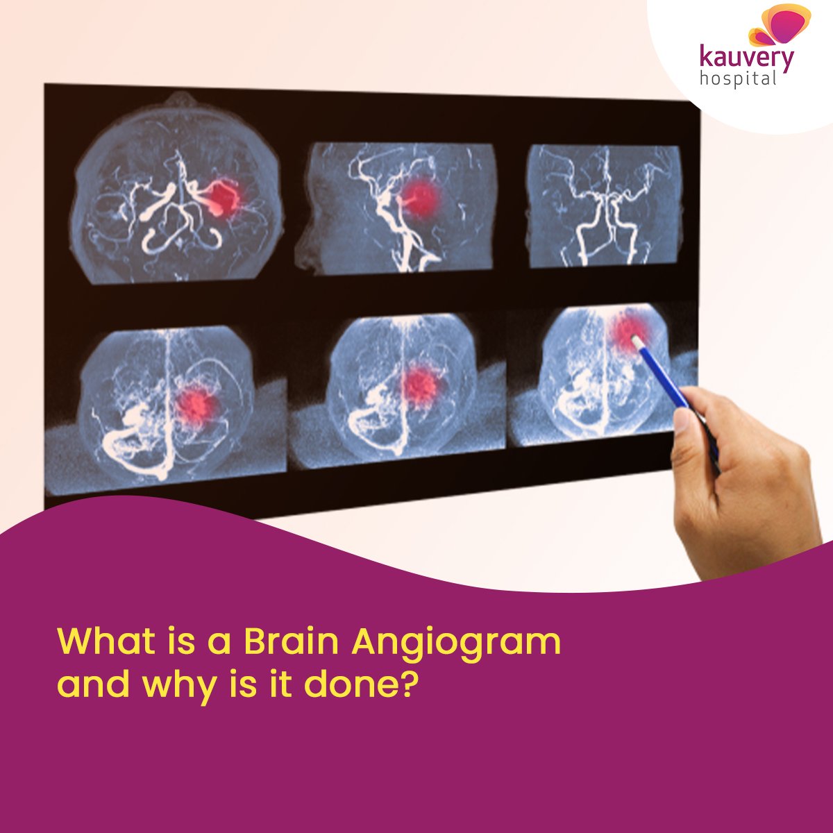 What is a Brain Angiogram