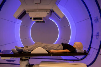 Side-effects of Radiation Therapy