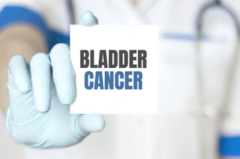 Bladder Cancer: Diagnosis, Staging and Treatment Strategies