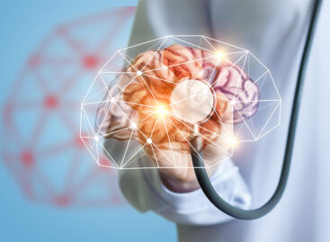 Revolutionizing Neuro Care – The Rise of Interventional Neurology