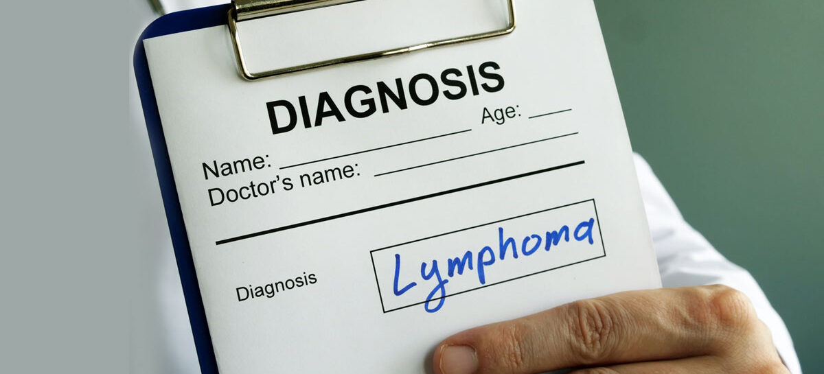 Lymphoma – an overview, types, and genetic risks