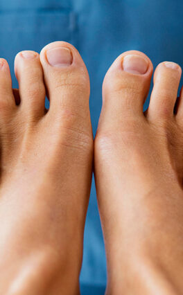 How to save your Diabetic Foot from Amputation?