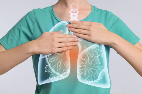 The 5 signs of Acute Respiratory Distress Syndrome