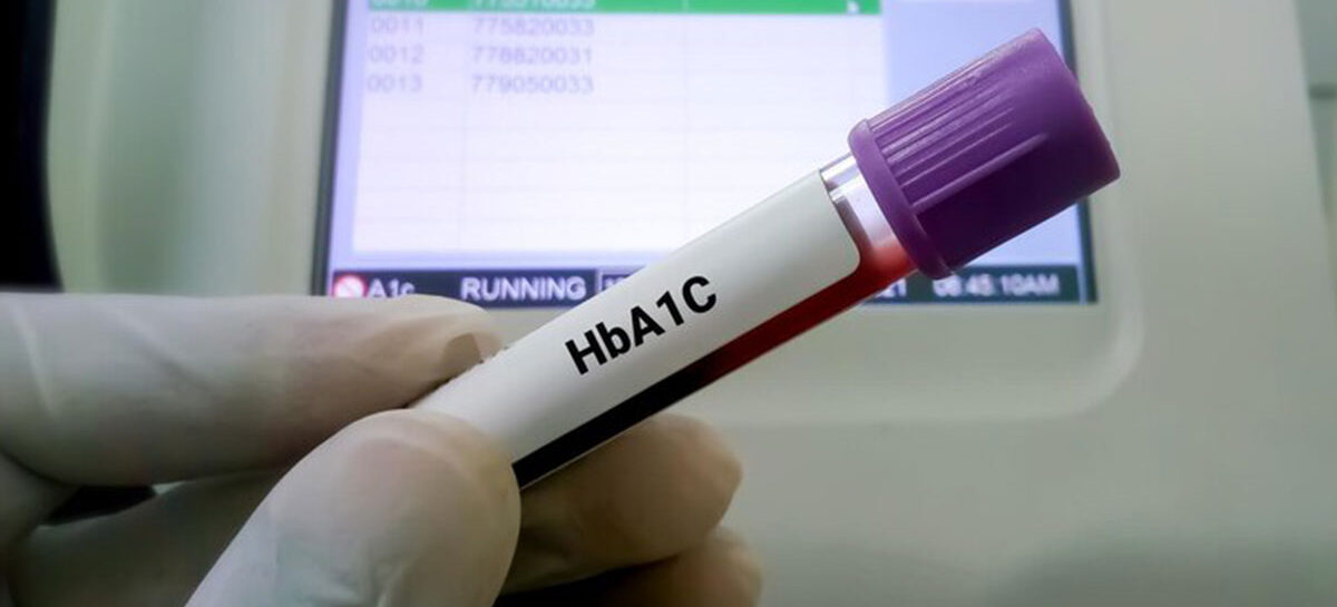 நீரிழிவாளர்களுக்கு உதவும் HbA1c சோதனை