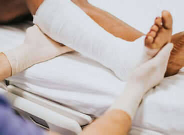 Fracture Cast Care