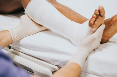 Fracture Cast Care