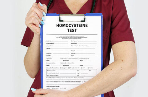 What happens if homocysteine is high?