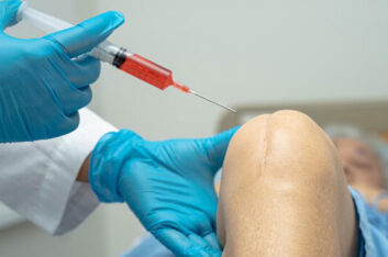 PRP injections for knee pain – How effective are they?