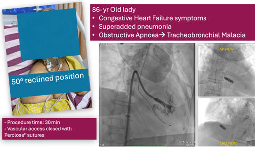 EXAMPLES OF CASES FROM KAUVERY HOSPITAL