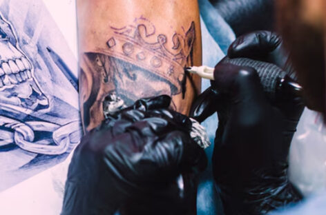 Everything you need to know about laser tattoo removal