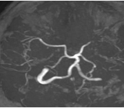 MRA MIP images