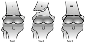 SU CLASSIFICATION