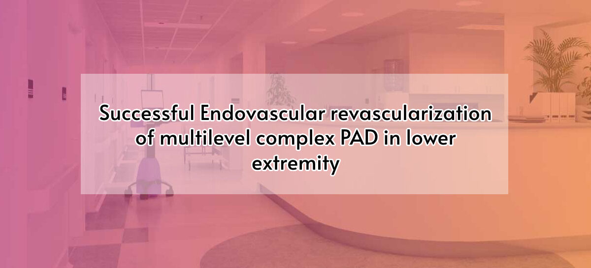 Successful Endovascular revascularization of multilevel complex PAD in lower extremity