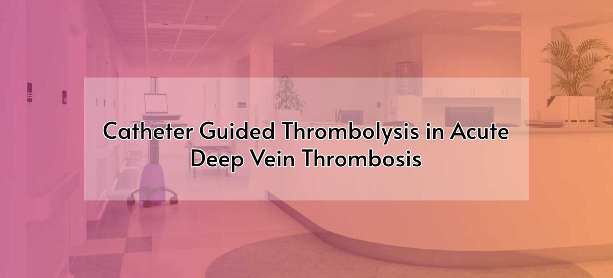 Catheter Guided Thrombolysis in Acute Deep Vein Thrombosis