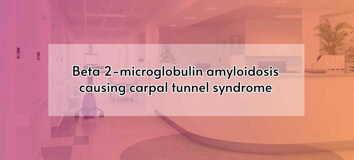 Beta 2-microglobulin amyloidosis causing carpal tunnel syndrome