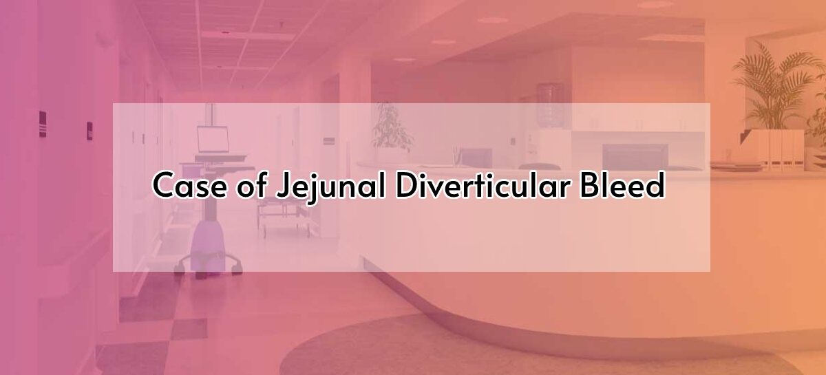 Case of Jejunal Diverticular Bleed