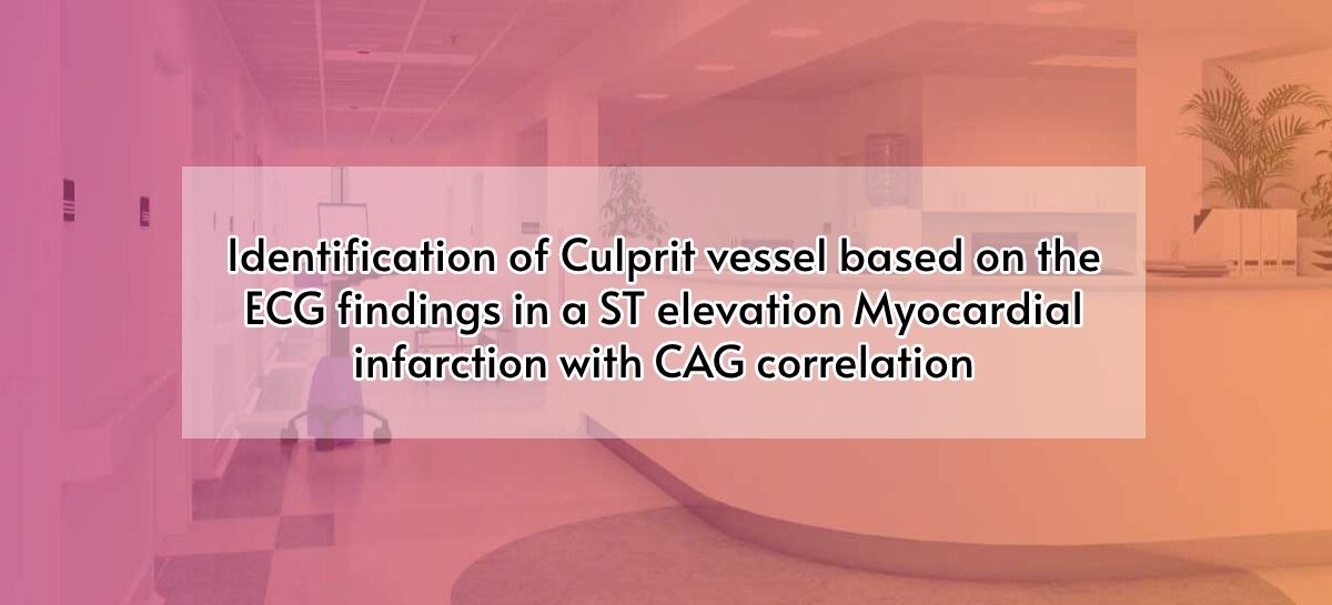 Identification of Culprit vessel based on the ECG findings in a ST elevation Myocardial infarction with CAG correlation