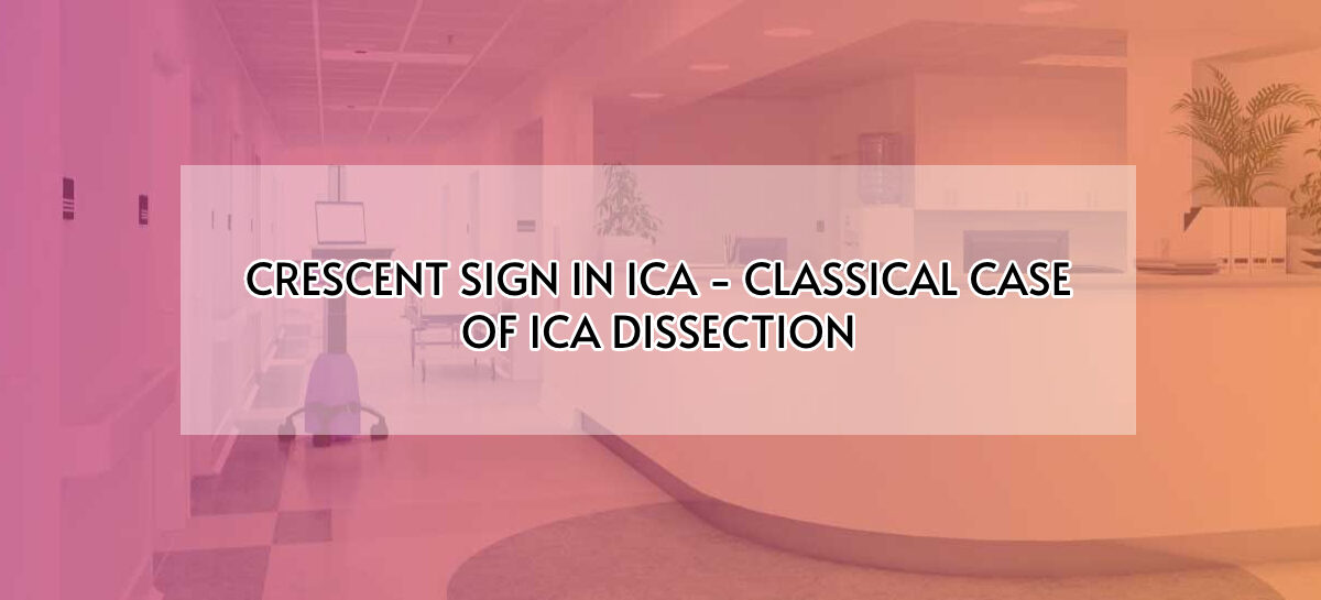 CRESCENT SIGN IN ICA – CLASSICAL CASE OF ICA DISSECTION